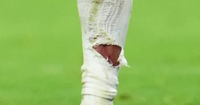 Фотографија од ногата на Мбапе стана вирална: Како е можно ова да не е црвен картон?